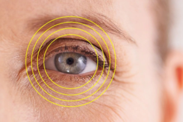 How LASIK Surgery Improves Eye Health and Vision Clarity