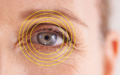 How LASIK Surgery Improves Eye Health and Vision Clarity