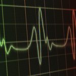 Frequent Heart Palpitations - Track Patterns Before Medical Visits