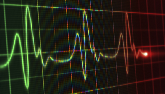 Frequent Heart Palpitations - Track Patterns Before Medical Visits